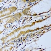 Polyclonal Rabbit anti-Human ERG Antibody (IHC, IF, WB)