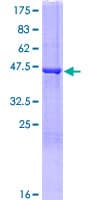 Human FGF16 Protein (Recombinant GST)