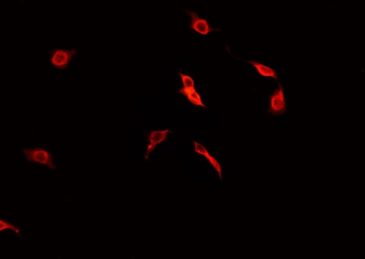 PDGFRA / PDGFR Alpha Antibody
