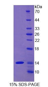 Human GPT / Alanine Transaminase Protein (Recombinant His)