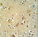 CDH20 / Cadherin 20 Antibody (aa111-140)