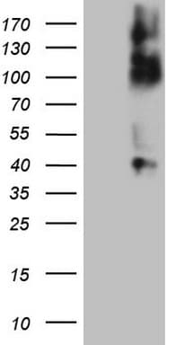 TNFRSF14 / CD270 / HVEM Antibody (aa39-283, clone OTI7D7, Carrier-free)