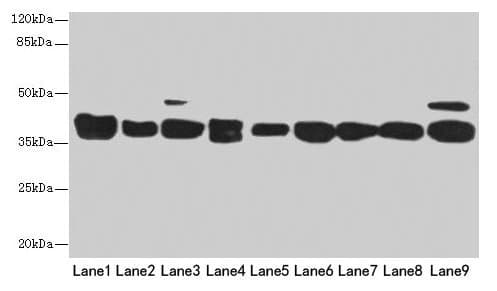 DNAJB1 / Hsp40 Antibody