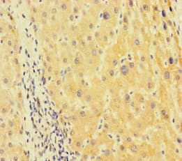 Polyclonal Rabbit anti-Human TUBA1B / Tubulin Alpha 1B Antibody (IHC, IF, WB)