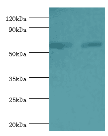 ATP5B / ATP Synthase Beta Antibody (aa230-529)