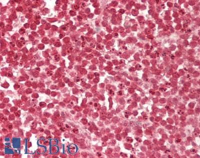 IHC-plus™ Polyclonal Rabbit anti-Human TRPS1 Antibody (aa1000-1050, IHC, WB)