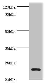 APOBEC3C Antibody (aa1-190)