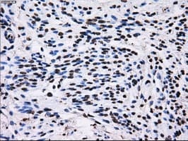 RPA2 / RFA2 / RPA34 Antibody (clone OTI7C12)