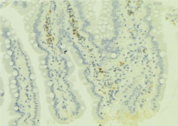 ADAMDEC1 Antibody
