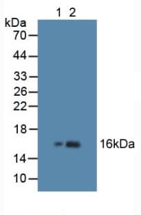 HBB / Hemoglobin Beta Antibody (aa1-147)