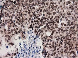 SNX8 Antibody (clone OTI1E5)