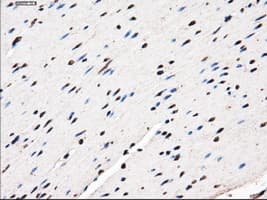 LEMD3 / MAN1 Antibody (clone OTI4E1, Carrier-free)