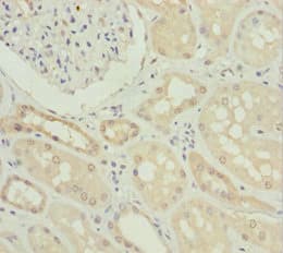 Polyclonal Rabbit anti-Human NYX Antibody (IHC, WB)