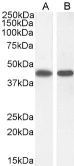 IHC-plus™ ASS1 / ASS Antibody (aa196-212)