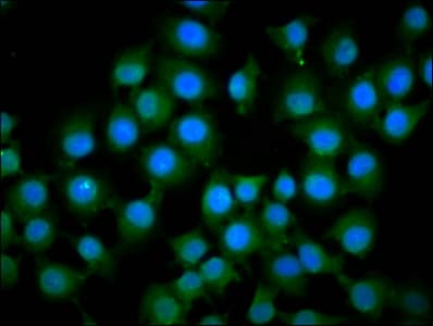 IFT172 Antibody