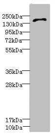 GRIN2D / NMDAR2D / NR2D Antibody