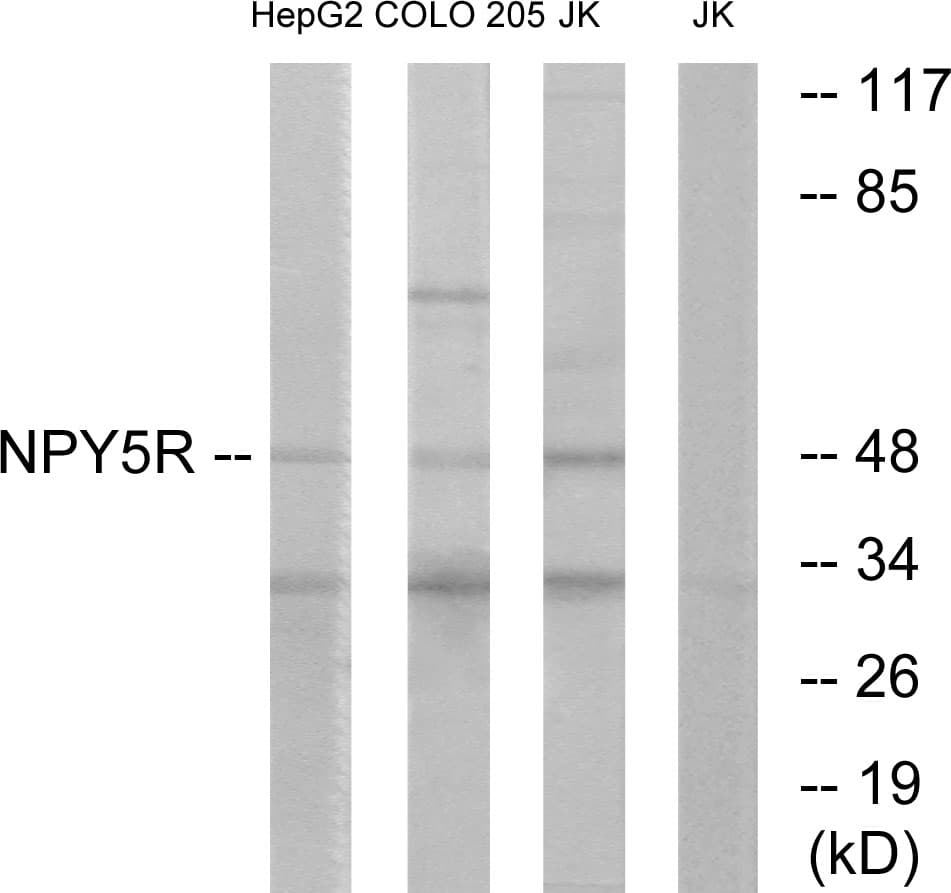 IHC-plus™ Polyclonal Rabbit anti-Human NPY5R Antibody (aa221-270, IHC, IF, WB)