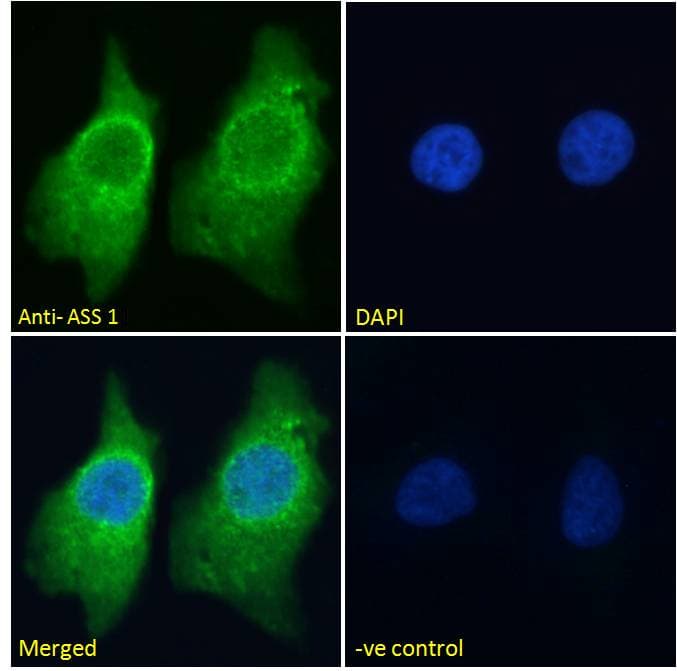 IHC-plus™ ASS1 / ASS Antibody (aa196-212)
