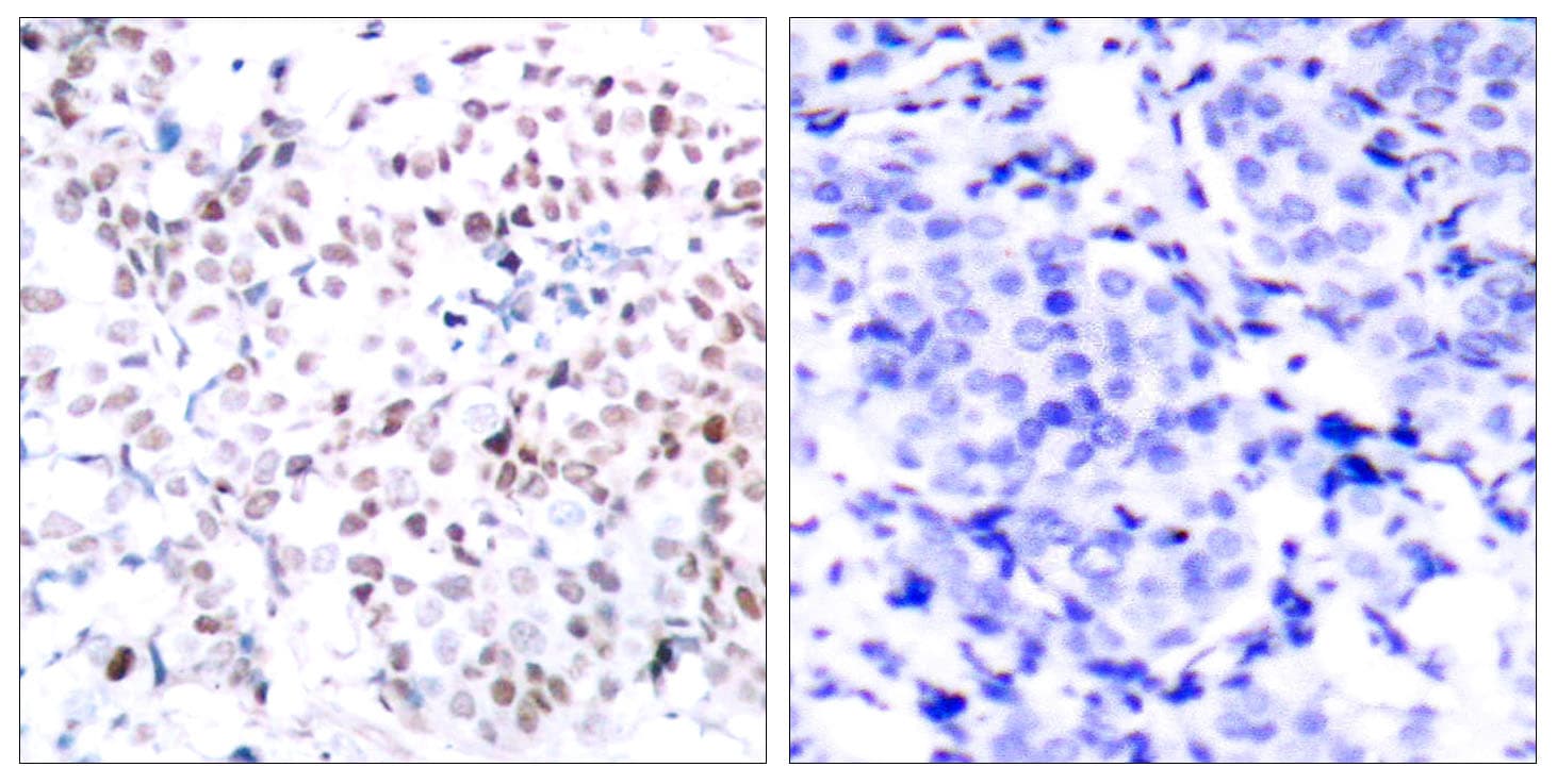 MYC / c-Myc Antibody (phospho-Thr358)