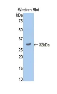 CYP2E1 Antibody (aa34-273, Cy3)