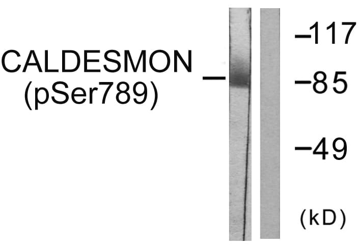 CALD1 / Caldesmon Antibody (phospho-Ser789)