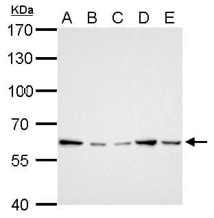 IHC-plus™ GGT1 / GGT Antibody (aa1-226)