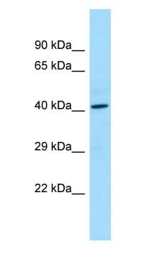FDPS Antibody (aa197-246)
