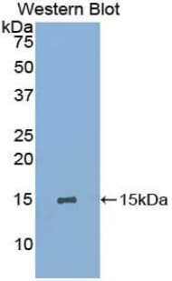 GYPA / CD235a / Glycophorin A Antibody (aa1-108)
