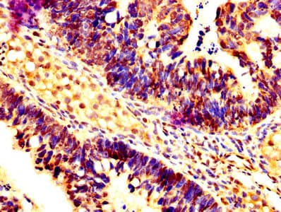 CASP7 / Caspase 7 Antibody
