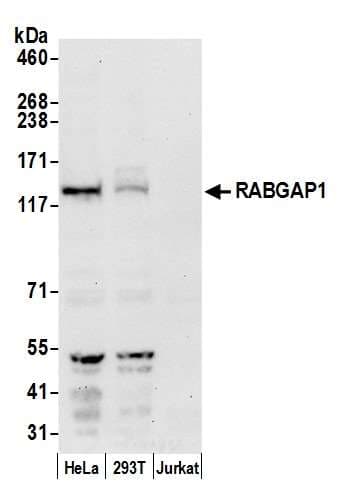 RABGAP1 Antibody (aa1-50)