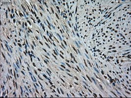 MAPK1 / ERK2 Antibody (clone OTI6E5)