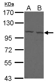 Polyclonal Rabbit anti-Human FCRL5 / CD307 Antibody (WB)
