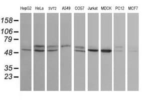 STK38L / NDR2 Antibody (clone OTI4D8)