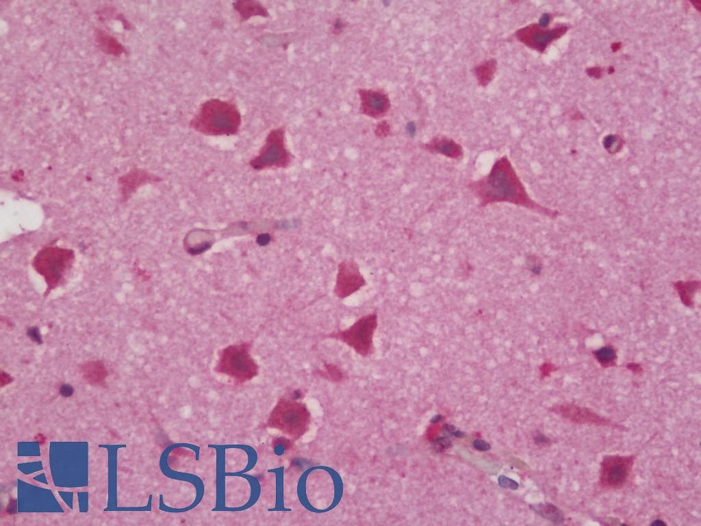 IHC-plus™ SCN1B Antibody (N-Terminus)