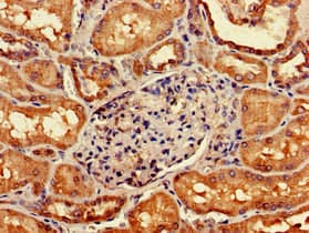 GIPC1 / GIPC Antibody