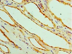 GPT / Alanine Transaminase Antibody (aa2-496)