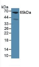 GPC3 / Glypican 3 Antibody (aa344-559, Cy3)