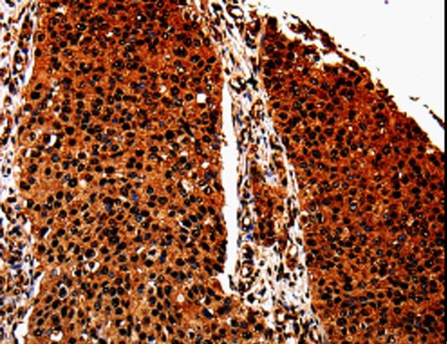 ANXA7 / Annexin VII / SNX Antibody
