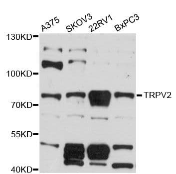 VRL1 / TRPV2 Antibody