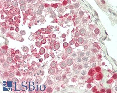 IHC-plus™ Polyclonal Rabbit anti-Human CRTC1 / MECT1 / TORC1 Antibody (aa600-C-term, IHC, WB)