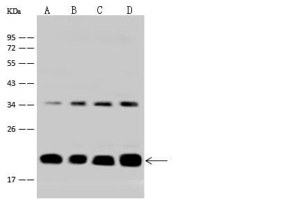 ICT1 / DS1 Antibody