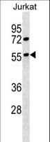 RAIG2 / GPRC5B Antibody (aa293-321)