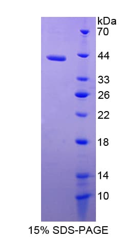 Human KIR2DL5B Protein (Recombinant His-T7)