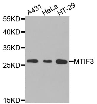 Polyclonal Rabbit anti-Human IF3mt / MTIF3 Antibody (IHC, WB)