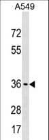 ART5 Antibody (aa148-177)