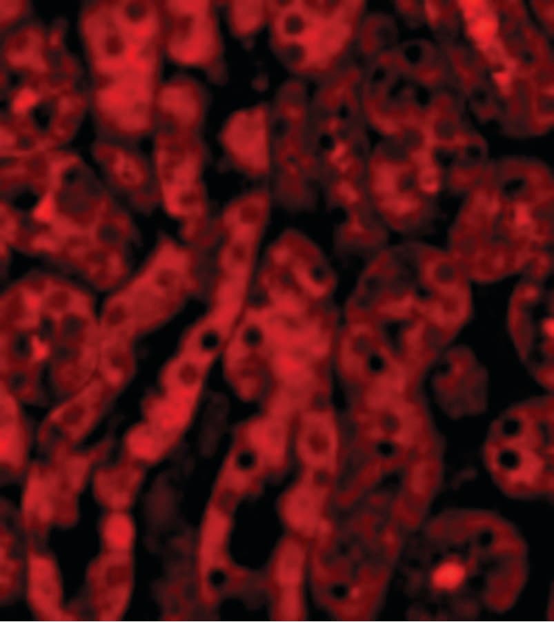 TICAM2 / TRAM Antibody