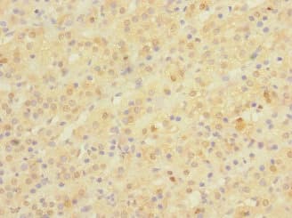 NPM2 Antibody