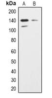 INPPL1 / SHIP2 Antibody (Internal)