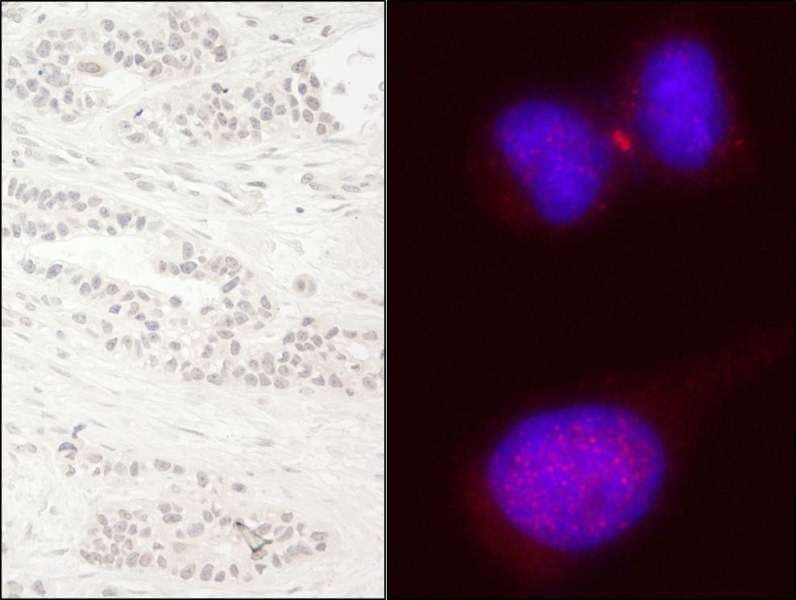 KIF14 Antibody (aa1600-C-term)