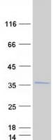 Human RPL8 / Ribosomal Protein L8 (Recombinant Myc-DDK (Flag))